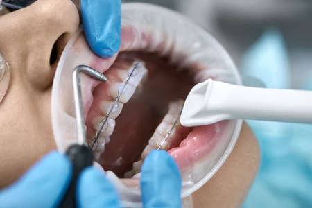 Pretty womans teeth cleaning in dental clinicの写真素材