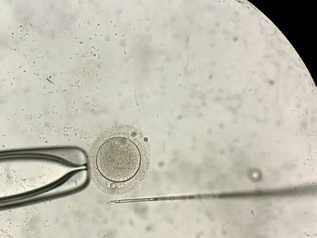 View through microscope at in vitro fertilization processの写真素材
