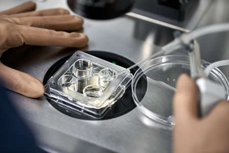 Process of in vitro fertilization in laboratoryの写真素材