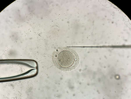 View through microscope at in vitro fertilization processの写真素材