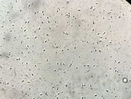 View at human sperm under microscope in labの写真素材