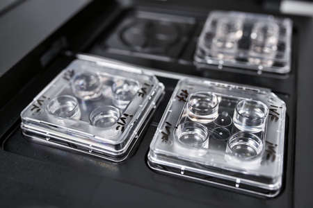 Equipment for in vitro fertilization in laboratoryの写真素材