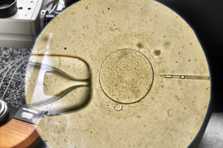 View through microscope at in vitro fertilization processの写真素材