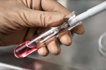 Process of in vitro fertilization in laboratoryの写真素材
