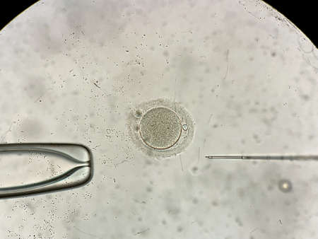 View through microscope at in vitro fertilization processの写真素材