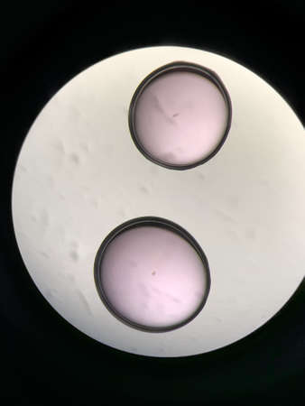 View through microscope at in vitro fertilization processの写真素材