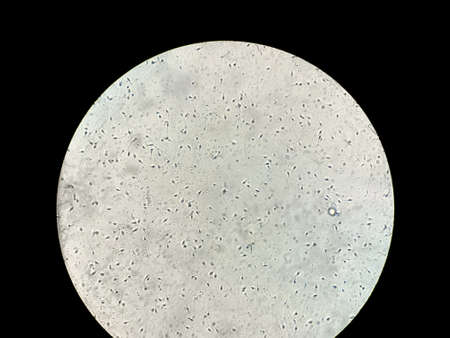 View at human sperm under microscope in labの写真素材