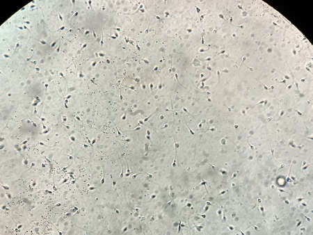 View at human sperm under microscope in labの写真素材