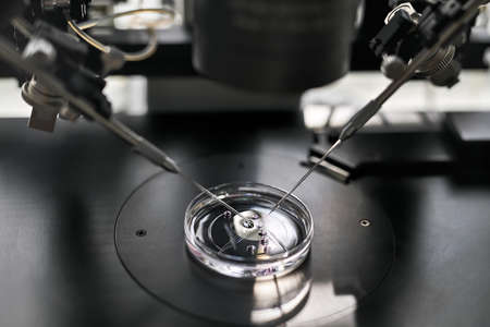 Process of in vitro fertilization in laboratoryの写真素材
