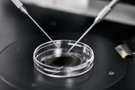 Process of in vitro fertilization in laboratoryの写真素材
