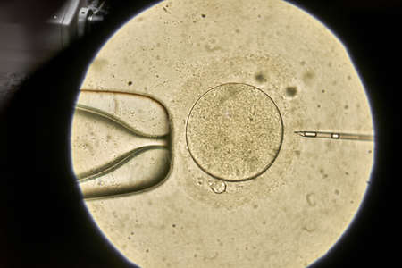 View through microscope at in vitro fertilization processの写真素材