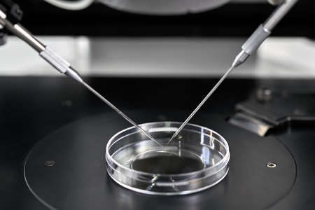 Process of in vitro fertilization in laboratoryの写真素材