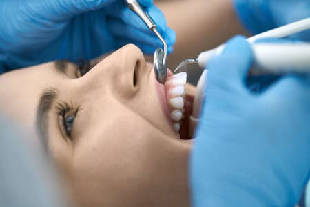Pretty womans teeth treatment in dental clinicの写真素材
