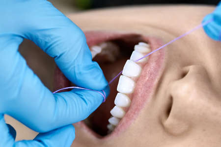 Pretty womans teeth cleaning in dental clinicの写真素材