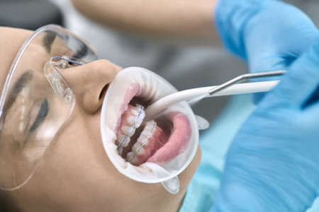 Pretty womans teeth cleaning in dental clinicの写真素材