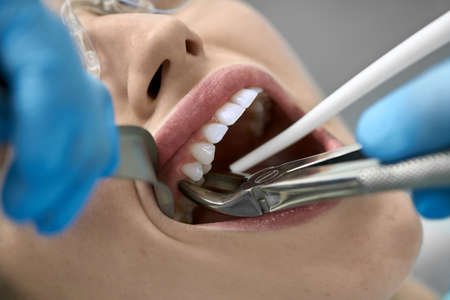 Pretty womans teeth treatment in dental clinicの写真素材