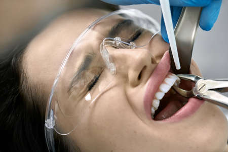 Pretty womans teeth treatment in dental clinicの写真素材
