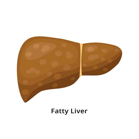 Fatty liver icon isolated on white background. Liver disease concept illustration in flat designのイラスト素材
