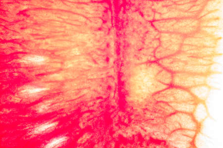 Watermelon texture backgroundの写真素材