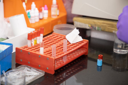Lots of medicines test-tubes for collecting blood samples diagnosis research