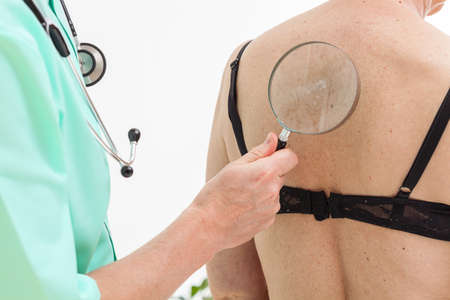 A dermatologist using a magnifying glass on a birthmark