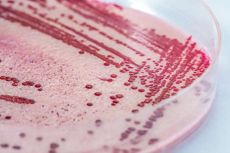 Listeria, bacteria in a petri dish, closeupの写真素材