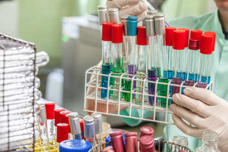 Test tubes on the stand in the hands of lab worker
