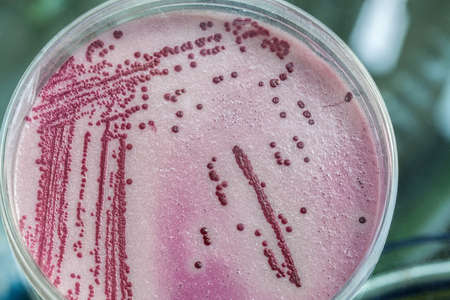 Petri dish full of pink and red microbacteriasの写真素材