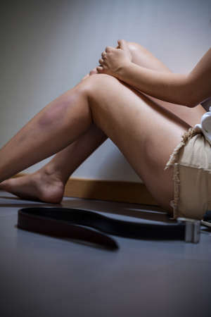 View of female victim of the violenceの写真素材