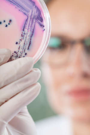 Petri plate with microbacteria holded by biologist