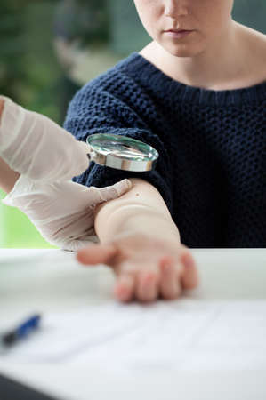 Nurse checking the young patient's arm by the magnifying glassの写真素材