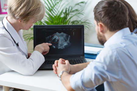 Gynecologist showing to young married couple fetus ultrasoundの写真素材