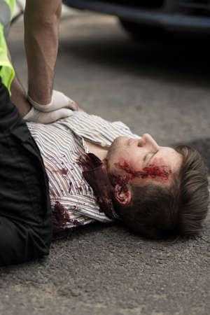 Paramedic applying first aid victim of car crashの写真素材