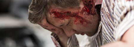 Young man seriously injured on head and arm