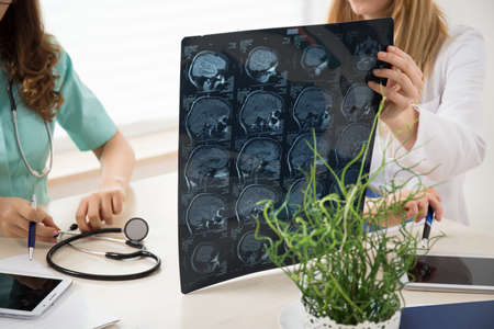 Young doctor holding patient's brain scanning image