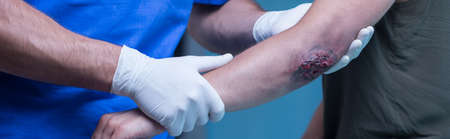 Panorama of patient with hand wound on medical consultation