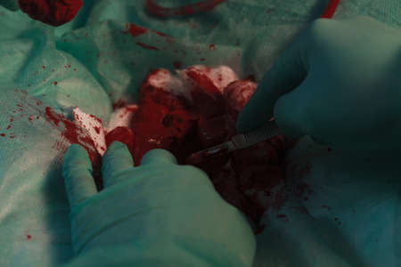 Close up of surgeon hands with scalpel during operationの写真素材
