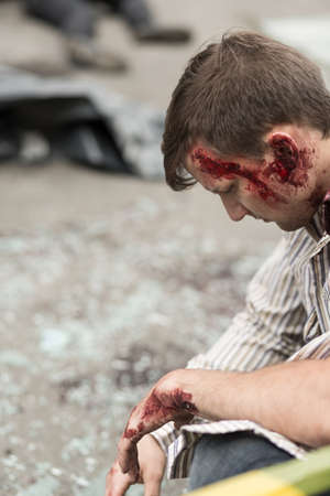 Injured man with bloody head wound.の写真素材