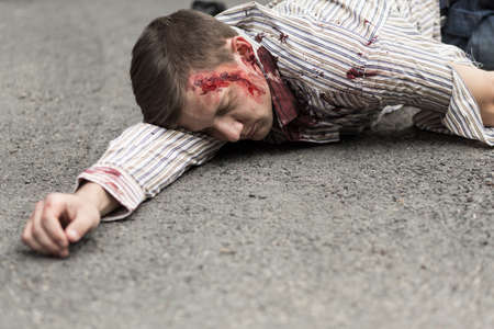Photo of car accident victim lying on streetの写真素材
