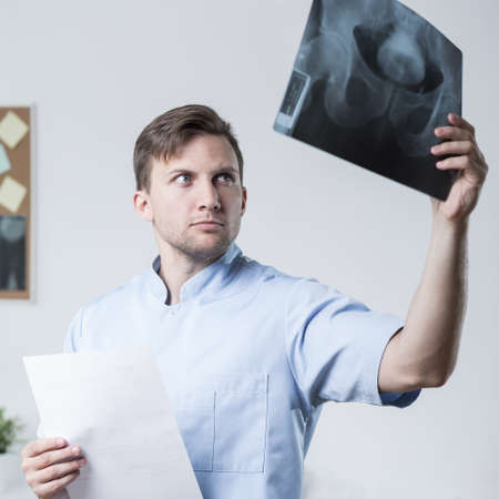 Young doctor looking at x-ray photo of pelvisの写真素材