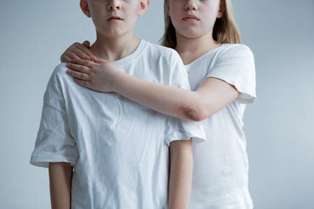 Physical aggression against children - conceptual photo