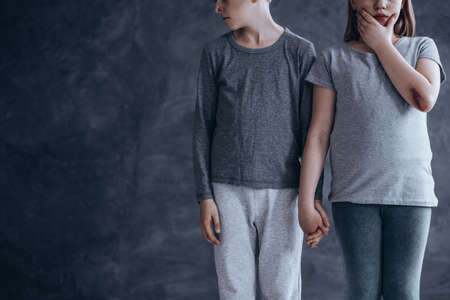 Child abuse and neglect concept, lonely and isolated children with bruisesの写真素材