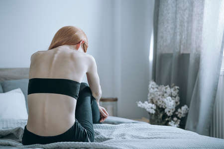 Young woman with anorexia sitting alone on bed and feeling unhappy. Anorexia problem conceptの写真素材