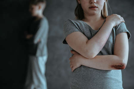 Young girl with wound and bruises being a sexual abuse victimの写真素材