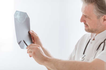 Doctor examining lung's x-ray at bright hospital officeの写真素材