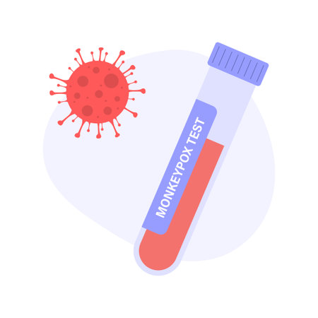 Monkeypox virus test. Flask with bloodのイラスト素材