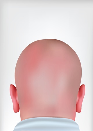 bald headの写真素材