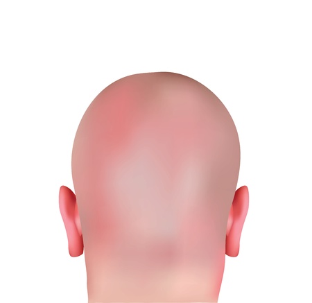 Realistic Bald Head のイラスト素材