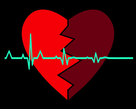 broken heart with flatline on black background. vector illustration.のイラスト素材