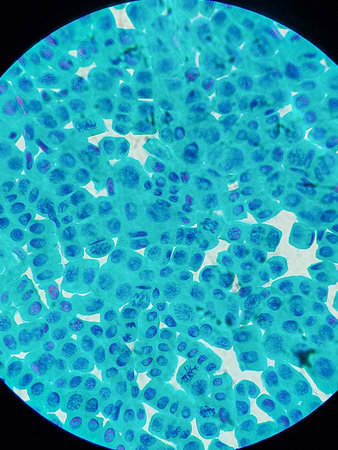 Onion cell mitosis under microscope at 40x magnification showing plant chromosomes and dividing...
